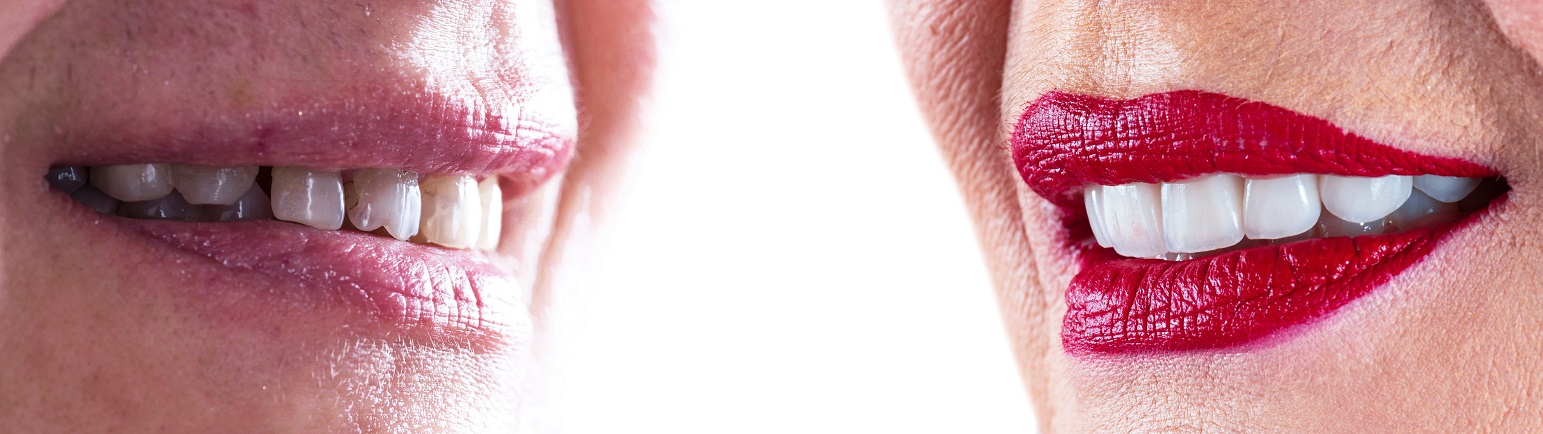ESTHETIC DENTISTRY